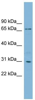 WB Suggested Anti-TBCCD1 Antibody Titration: 0.2-1 ug/ml; Positive Control: Hela cell lysate