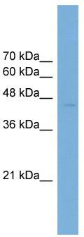 WB Suggested Anti-ARFGAP1 Antibody Titration: 0.2-1 ug/ml; ELISA Titer: 1:312500; Positive Control: Transfected 293T