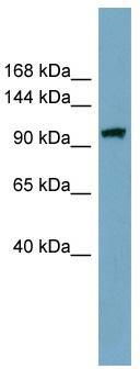 WB Suggested Anti-ELP2 Antibody Titration: 0.2-1 ug/ml; Positive Control: THP-1 cell lysate