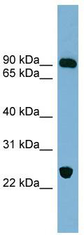WB Suggested Anti-VPS53 Antibody Titration: 0.2-1 ug/ml; ELISA Titer: 1:312500; Positive Control: Human Muscle