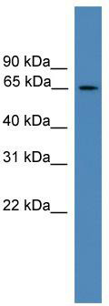 WB Suggested Anti-TBC1D19 Antibody Titration: 0.2-1 ug/ml; ELISA Titer: 1:312500; Positive Control: HT1080 cell lysate