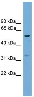 WB Suggested Anti-RSAD1 Antibody Titration: 0.2-1 ug/ml; ELISA Titer: 1:1562500; Positive Control: 293T cell lysateRSAD1 is supported by BioGPS gene expression data to be expressed in HEK293T