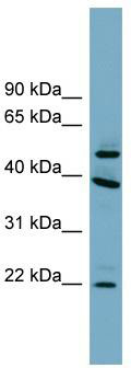 WB Suggested Anti-C4orf20 Antibody Titration: 0.2-1 ug/ml; Positive Control: Human brain