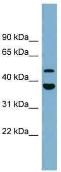 WB Suggested Anti-C4orf20 Antibody Titration: 0.2-1 ug/ml; Positive Control: Human heart