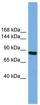 WB Suggested Anti-RSBN1 Antibody Titration: 0.2-1 ug/ml; ELISA Titer: 1:1562500; Positive Control: Human Lung