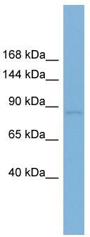 WB Suggested Anti-RSBN1 Antibody Titration: 0.2-1 ug/ml; Positive Control: 721_B cell lysateRSBN1 is supported by BioGPS gene expression data to be expressed in 721_B