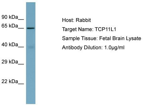 Host: Rabbit; Target Name: TCP11L1; Sample Tissue: Fetal Brain lysates; Antibody Dilution: 1.0 ug/ml