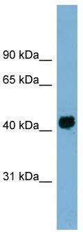 WB Suggested Anti-KIAA1704 Antibody Titration: 0.2-1 ug/ml; Positive Control: Human Spleen