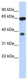 Western blot analysis of extracts of 293T cells, using CAS9 antibody (TA374273) at 1:1000 dilution.|Secondary antibody: HRP Goat Anti-Rabbit IgG (H+L) at 1:10000 dilution.|Lysates/proteins: 25ug per lane.|Blocking buffer: 3% nonfat dry milk in TBST.|Detection: ECL Basic Kit .|Exposure time: 30s.