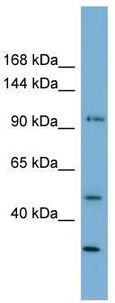 WB Suggested Anti-FAM35A Antibody Titration: 0.2-1 ug/ml; Positive Control: MCF7 cell lysate