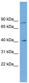 WB Suggested Anti-CPXM1 Antibody Titration: 0.2-1 ug/ml; ELISA Titer: 1:1562500; Positive Control: Human Lung