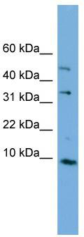 WB Suggested Anti-C16orf61 Antibody Titration: 0.2-1 ug/ml; ELISA Titer: 1:1562500; Positive Control: Human kidney