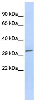 WB Suggested Anti-PDXP Antibody Titration: 0.2-1 ug/ml; ELISA Titer: 1:312500; Positive Control: Jurkat cell lysate