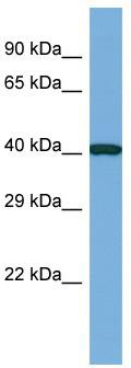Host: Rabbit; Target Name: CASS4; Sample Tissue: RPMI-8226 Whole Cell lysates; Antibody Dilution: 1.0 ug/ml; CASS4 is supported by BioGPS gene expression data to be expressed in RPMI 8226