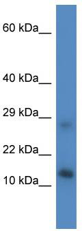 WB Suggested Anti-Lyrm4 Antibody; Titration: 1.0 ug/ml; Positive Control: Mouse Liver