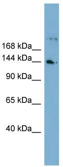 WB Suggested Anti-WDR35 Antibody Titration: 0.2-1 ug/ml; Positive Control: Human Lung