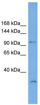WB Suggested Anti-DENND1A Antibody Titration: 0.2-1 ug/ml; Positive Control: Human Muscle