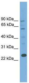 WB Suggested Anti-BCL7A Antibody Titration: 0.2-1 ug/ml; ELISA Titer: 1:62500; Positive Control: 721_B cell lysateBCL7A is supported by BioGPS gene expression data to be expressed in 721_B