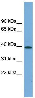 WB Suggested Anti-PLEKHA1 Antibody Titration: 0.2-1 ug/ml; Positive Control: Human Lung