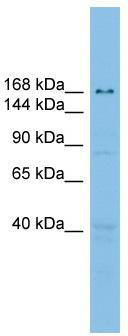 WB Suggested Anti-UBE2O Antibody Titration: 0.2-1 ug/ml; ELISA Titer: 1:62500; Positive Control: RPMI 8226 cell lysateUBE2O is supported by BioGPS gene expression data to be expressed in RPMI 8226