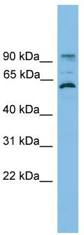 WB Suggested Anti-ANKRD5 Antibody Titration: 0.2-1 ug/ml; Positive Control: HT1080 cell lysate