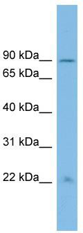 WB Suggested Anti-ANKRD5 Antibody Titration: 0.2-1 ug/ml; ELISA Titer: 1:1562500; Positive Control: ACHN cell lysate