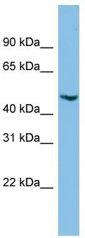 WB Suggested Anti-C17orf75 Antibody Titration: 0.2-1 ug/ml; ELISA Titer: 1:312500; Positive Control: HepG2 cell lysate