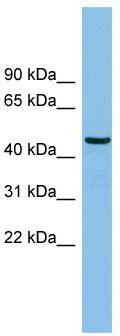 WB Suggested Anti-HS1BP3 Antibody Titration: 0.2-1 ug/ml; ELISA Titer: 1:1562500; Positive Control: Human brain