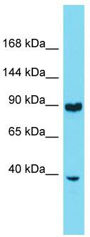 Host: Rabbit; Target Name: Rnf216; Sample Tissue: Mouse Thymus lysates; Antibody Dilution: 1.0 ug/ml