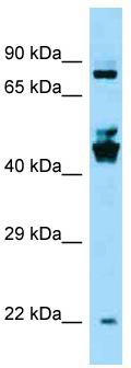 Host: Rabbit; Target Name: SPDYE3; Sample Tissue: OVCAR-3 whole cell lysates; Antibody Dilution: 1.0 ug/ml