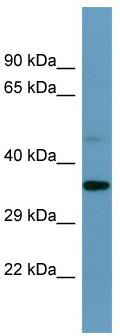 Host: Rabbit; Target Name: SPDYE1; Sample Tissue: U937 Whole cell lysates; Antibody Dilution: 1.0 ug/ml