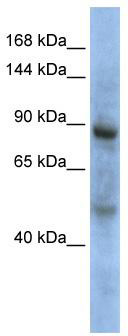WB Suggested Anti-ZHX3 Antibody Titration: 0.2-1 ug/ml; ELISA Titer: 1:12500; Positive Control: MCF7 cell lysate