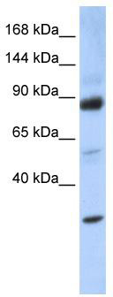 WB Suggested Anti-ZHX3 Antibody Titration: 0.2-1 ug/ml; ELISA Titer: 1:62500; Positive Control: 293T cell lysate