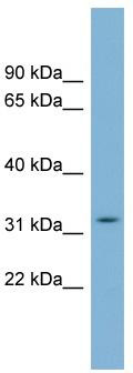 WB Suggested Anti-C22orf31 Antibody Titration: 0.2-1 ug/ml; Positive Control: Human Small Intestine