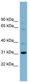 WB Suggested Anti-C22orf31 Antibody Titration: 0.2-1 ug/ml; ELISA Titer: 1:312500; Positive Control: Human Spleen