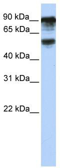 WB Suggested Anti-TBC1D10B Antibody Titration: 0.2-1 ug/ml; ELISA Titer: 1:312500; Positive Control: Hela cell lysate