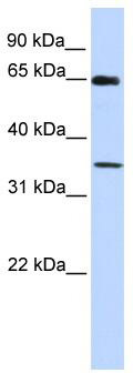 WB Suggested Anti-GTF2B Antibody Titration: 0.2-1 ug/ml; ELISA Titer: 1:62500; Positive Control: Human Placenta