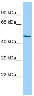 Host: Rabbit; Target Name: Zfp566; Sample Tissue: Rat Spleen lysates; Antibody Dilution: 1.0 ug/ml