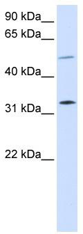 WB Suggested Anti-SHOX2 Antibody Titration: 0.2-1 ug/ml; ELISA Titer: 1:62500; Positive Control: 293T cell lysate