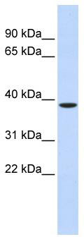 WB Suggested Anti-ZFPL1 Antibody Titration: 0.2-1 ug/ml; ELISA Titer: 1:312500; Positive Control: Human Liver
