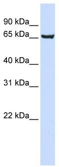 WB Suggested Anti-SOX13 Antibody Titration: 0.2-1 ug/ml; ELISA Titer: 1:62500; Positive Control: 293T cell lysate