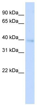 WB Suggested Anti-HOXA11 Antibody Titration: 0.2-1 ug/ml; ELISA Titer: 1:312500; Positive Control: Transfected 293T