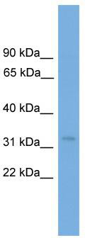 WB Suggested Anti-TCEA2 Antibody Titration: 0.2-1 ug/ml; Positive Control: 293T cell lysate