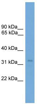 WB Suggested Anti-TCEA2 Antibody Titration: 0.2-1 ug/ml; ELISA Titer: 1:2500; Positive Control: 293T cell lysate