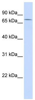WB Suggested Anti-ZNF442 Antibody Titration: 0.2-1 ug/ml; ELISA Titer: 1:312500; Positive Control: Human Liver