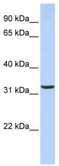 WB Suggested Anti-JMJD8 Antibody Titration: 0.2-1 ug/ml; ELISA Titer: 1:312500; Positive Control: MCF7 cell lysate
