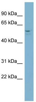 WB Suggested Anti-ACD Antibody Titration: 0.2-1 ug/ml; Positive Control: NCI-H226 cell lysate