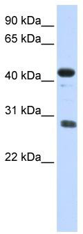 WB Suggested Anti-CDCA5 Antibody Titration: 0.2-1 ug/ml; ELISA Titer: 1:1562500; Positive Control: Human Placenta