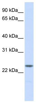WB Suggested Anti-NPM2 Antibody Titration: 0.2-1 ug/ml; ELISA Titer: 1:312500; Positive Control: Human Placenta