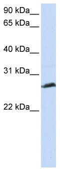 WB Suggested Anti-SYCP3 Antibody Titration: 0.2-1 ug/ml; ELISA Titer: 1:312500; Positive Control: Jurkat cell lysate